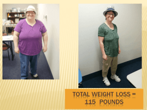 woman, before and after losing 115 pounds